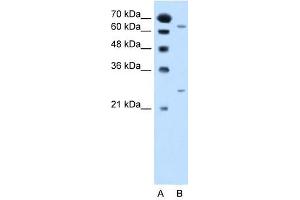 NAT2 antibody used at 2.