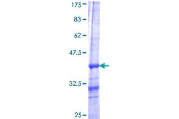 PIP4K2B Protein (AA 73-160) (GST tag)