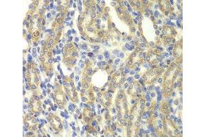 Immunohistochemistry of paraffin-embedded Rat kidney using KBTBD7 Polyclonal Antibody at dilution of 1:100 (40x lens). (KBTBD7 antibody)