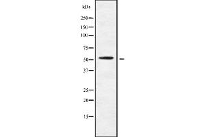 Western blot analysis of mAChR M4 using K562 whole cell lysates (CHRM4 antibody  (Internal Region))