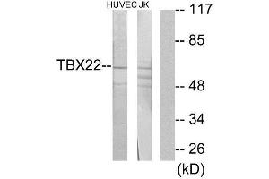 Western Blotting (WB) image for anti-T-Box 22 (TBX22) (N-Term) antibody (ABIN1850120) (T-Box 22 antibody  (N-Term))