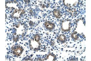 GUSB antibody was used for immunohistochemistry at a concentration of 4-8 ug/ml to stain Alveolar cells (arrows) in Human Lung.