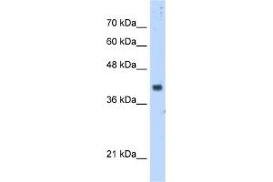 WB Suggested Anti-PDSS1 Antibody Titration:  5. (PDSS1 antibody  (Middle Region))