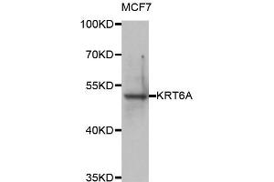 Western blot analysis of extracts of MCF7 cell line, using KRT6A antibody. (KRT6A antibody)