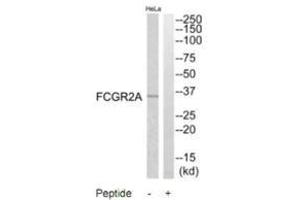 Western blot analysis of extracts from HeLa cells, using FCGR2A antibody. (FCGR2A antibody  (C-Term))