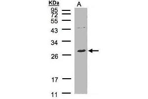 WB Image Sample(30 μg of whole cell lysate) A:Raji, 12% SDS PAGE antibody diluted at 1:500 (LAT2 antibody  (C-Term))