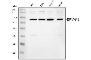 anti-Endogenous Retrovirus Group W, Member 1 (ERVW-1) (AA 406-435), (C-Term) antibody