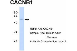 Western Blotting (WB) image for anti-Calcium Channel, Voltage-Dependent, beta 1 Subunit (CACNB1) (N-Term) antibody (ABIN2776092)