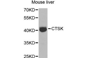Western blot analysis of extracts of mouse liver, using CTSK antibody (ABIN5970899) at 1/1000 dilution. (Cathepsin K antibody)