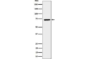 Western blot analysis of CTP synthase / CTPS expression in HeLa cell lysate. (Recombinant CTP Synthase antibody)