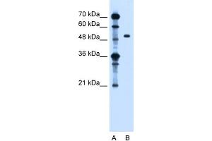 WB Suggested Anti-ZFYVE27 Antibody Titration:  1. (ZFYVE27 antibody  (Middle Region))