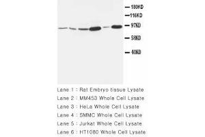 Image no. 1 for anti-Matrix Metallopeptidase 9 (Gelatinase B, 92kDa Gelatinase, 92kDa Type IV Collagenase) (MMP9) (AA 689-705) antibody (ABIN1493479) (MMP 9 antibody  (AA 689-705))