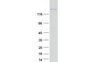Western Blotting (WB) image for Patatin-Like phospholipase Domain Containing 6 (PNPLA6) (Transcript Variant 1) protein (Myc-DYKDDDDK Tag) (ABIN2727675)