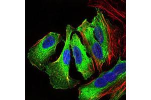 Immunocytochemistry (ICC) image for anti-Mitogen-Activated Protein Kinase 14 (MAPK14) (AA 299-360) antibody (ABIN1845584) (MAPK14 antibody  (AA 299-360))