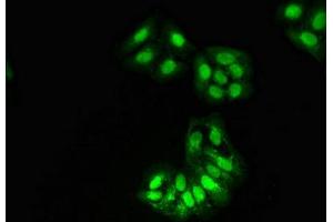 Immunofluorescent analysis of HepG2 cells using ABIN7155291 at dilution of 1:100 and Alexa Fluor 488-congugated AffiniPure Goat Anti-Rabbit IgG(H+L) (HAT1 antibody  (Catalytic Subunit))