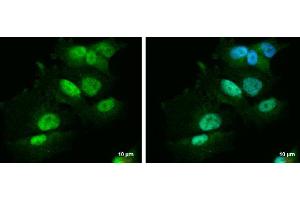 ICC/IF Image PBX1 antibody [N2C3] detects PBX1 protein at nucleus and cytoplasm by immunofluorescent analysis.