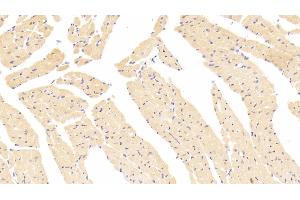 Immunohistochemistry (IHC) image for anti-Vinculin (VCL) (AA 879-1064) antibody (ABIN7434185)