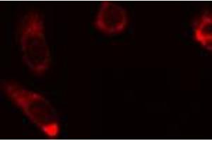 ABIN6274454 staining HuvEc cells by IF/ICC. (AKAP1 antibody  (Internal Region))