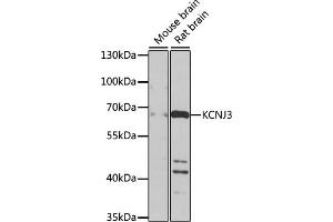 Western blot analysis of extracts of various cell lines, using KCNJ3 antibody (ABIN6134057, ABIN6142731, ABIN6142733 and ABIN6225132) at 1:1000 dilution. (KCNJ3 antibody  (AA 50-150))