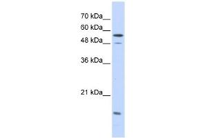 Karyopherin Alpha 2 antibody used at 1 ug/ml to detect target protein. (KPNA2 antibody)