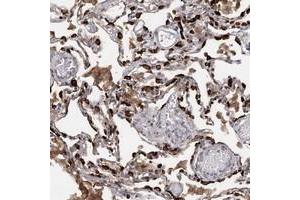 Immunohistochemical staining of human lung with SLC34A2 polyclonal antibody  shows strong cytoplasmic positivity in alveolar cells at 1:200-1:500 dilution. (SLC34A2 antibody)