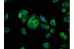 Immunofluorescence staining of A549 cells with ABIN7144503 at 1:66, counter-stained with DAPI. (Aquaporin 1 antibody  (AA 209-301))