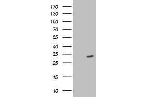 HEK293T cells were transfected with the pCMV6-ENTRY control (Left lane) or pCMV6-ENTRY SIRT5 (Right lane) cDNA for 48 hrs and lysed. (SIRT5 antibody)
