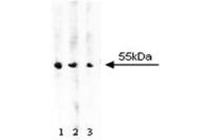 Western Blotting (WB) image for anti-Aldehyde Dehydrogenase (ALDH) (AA 7-128) antibody (ABIN968410) (Aldehyde Dehydrogenase antibody  (AA 7-128))