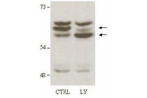 Immunoblotting. (AKT2 antibody)