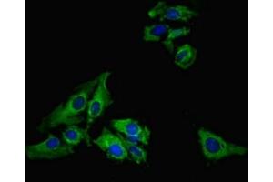 Immunofluorescent analysis of Hela cells using ABIN7158341 at dilution of 1:100 and Alexa Fluor 488-congugated AffiniPure Goat Anti-Rabbit IgG(H+L) (LIMS1 antibody  (AA 1-325))