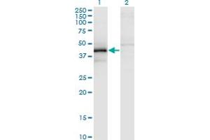 Western Blot analysis of ZFYVE19 expression in transfected 293T cell line by ZFYVE19 monoclonal antibody (M02), clone 3G4-2B11. (ZFYVE19 antibody  (AA 1-396))