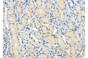 ABIN6263333 and ABIN6279546 at 1/100 staining Rat kidney tissue by IHC-P.