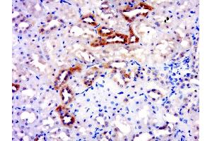 Paraformaldehyde-fixed, paraffin embedded rat kidney, Antigen retrieval by boiling in sodium citrate buffer (pH6. (SNX9 antibody  (AA 501-595))