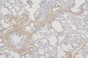 IHC analysis of TMEM255B using anti-TMEM255B antibody (ABIN7600444). (TMEM255B antibody  (AA 196-240))