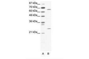Image no. 1 for anti-Forkhead Box K2 (FOXK2) (C-Term) antibody (ABIN202858) (Forkhead Box K2 antibody  (C-Term))