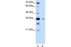 WB Suggested Anti-DAZAP1  Antibody Titration: 0. (DAZAP1 antibody  (C-Term))