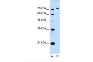 Image no. 1 for anti-GPI Anchor Attachment Protein 1 (GPAA1) (C-Term) antibody (ABIN6738244)