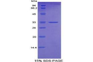 SDS-PAGE (SDS) image for Cytochrome P450, Family 24, Subfamily A, Polypeptide 1 (CYP24A1) protein (ABIN3009109)