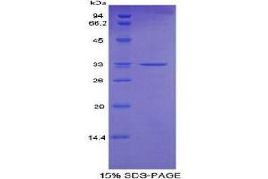SDS-PAGE analysis of Mouse Cytochrome P450 24A1 Protein. (CYP24A1 Protein)