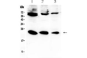 Western blot analysis of IL-2 using anti-IL-2 antibody . (IL-2 antibody  (AA 21-153))