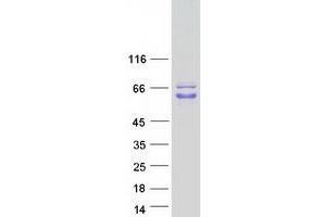 Validation with Western Blot (PAIP1 Protein (Transcript Variant 2) (Myc-DYKDDDDK Tag))