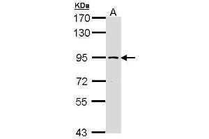 WB Image Sample (30 ug of whole cell lysate) A: Molt-4 , 7. (SSRP1 antibody)
