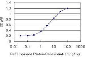 Detection limit for recombinant GST tagged GRK4 is approximately 0. (GRK4 antibody  (AA 36-145))