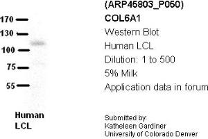 Image no. 2 for anti-Collagen, Type VI, alpha 1 (COL6A1) (Middle Region) antibody (ABIN502677) (COL6A1 antibody  (Middle Region))