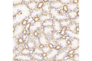 Immunohistochemistry of paraffin embedded mouse kidney using ATP1A1 (ABIN7073154) at dilution of 1: 500 (400x lens) (ATPase (Na/K) antibody)