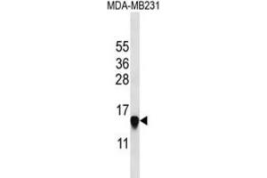 Western Blotting (WB) image for anti-Histone Cluster 2, H2aa3 (HIST2H2AA3) antibody (ABIN2997480) (HIST2H2AA3 antibody)