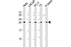 All lanes : Anti-SSX1 Antibody (Center) at 1:2000 dilution Lane 1: Hela whole cell lysate Lane 2: LNCaP whole cell lysate Lane 3: PC-3 whole cell lysate Lane 4: TT whole cell lysate Lane 5: human testis lysate Lysates/proteins at 20 μg per lane.