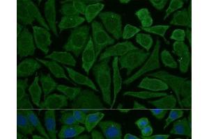 Immunofluorescence analysis of L929 cells using NDUFB2 Polyclonal Antibody at dilution of 1:100 (40x lens). (NDUFB2 antibody)