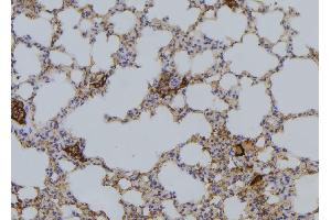 ABIN6276427 at 1/100 staining Mouse lung tissue by IHC-P. (RAP1A antibody  (C-Term))