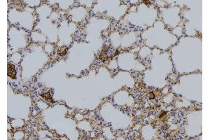 ABIN6276427 at 1/100 staining Mouse lung tissue by IHC-P. (RAP1A antibody  (C-Term))